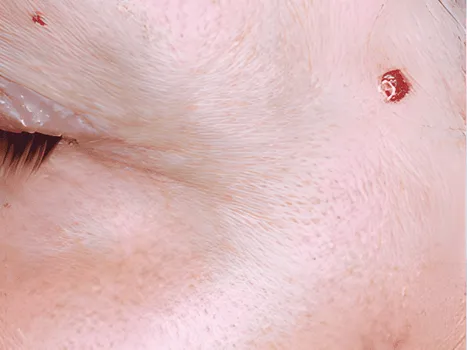 Luomen poisto before example 1