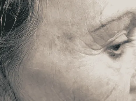 Luomen poisto after example 8