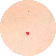 Banner kirsikkaluomi