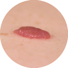 Banner mansikkaluomi