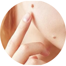 Luomen poisto banner person